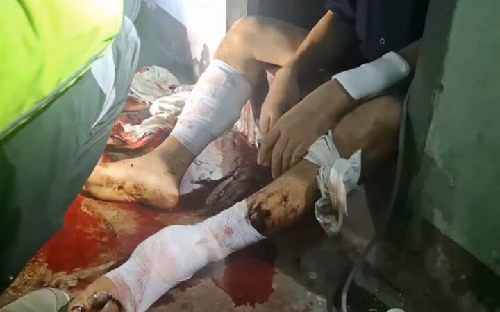 เมียทนไม่ไหวผัวมีชู้ ใช้มีดด้ายหญ้าฟันได้รับบาดเจ็บสาหัส เมีย เผย ฟันแค่สั่งสอนไม่ฟันให้ตาย