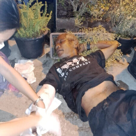 หนุ่มใหญ่ถูกฟันแขนเจ็บสาหัส สงสัยฝีมือเพื่อนนั่งรถเข็น เร่งเช็กวงจรปิดคลี่ปม