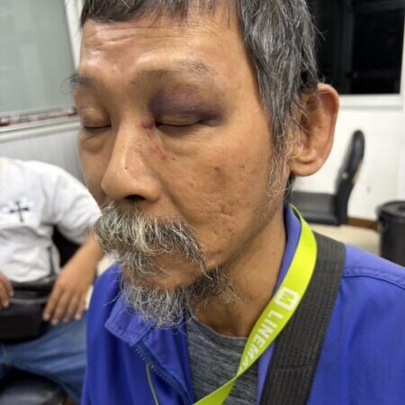 ปทุมธานี – ตร.เผยคดีศึกไรเดอร์ตะลุมบอนร้านหมูทอดเข้าข่ายสมัครใจทะเลาะวิวาทชี้ผู้บาดเจ็บอาการไม่ถึงขั้นวิกฤต