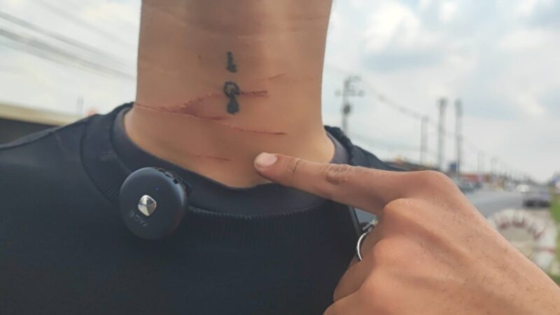 ปทุมธานีหนุ่ม 16 พร้อมแฟนสาวขี่ จยย.ถูกสายว่าวรัดคอหวิดดับ