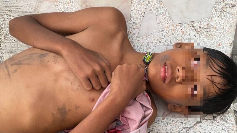 อุทาหรณ์ เด็กชาย วัย 12 ปี ไปยืนด้านหลังรุ่นพี่เหวี่ยงเบ็ดเกี่ยวคอบาดเจ็บ