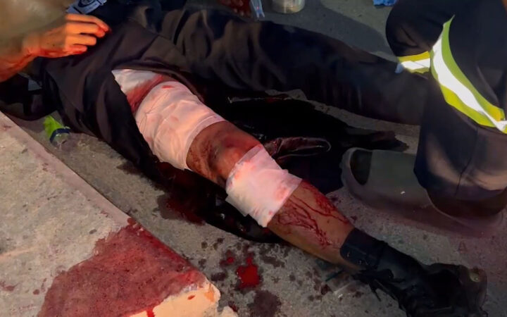 รปภ.สายโหดใช้มีดแทงหัวหน้ารปภ.สาหัส ฉุน “ห้ามศึกแย่งกาต้มน้ำ”