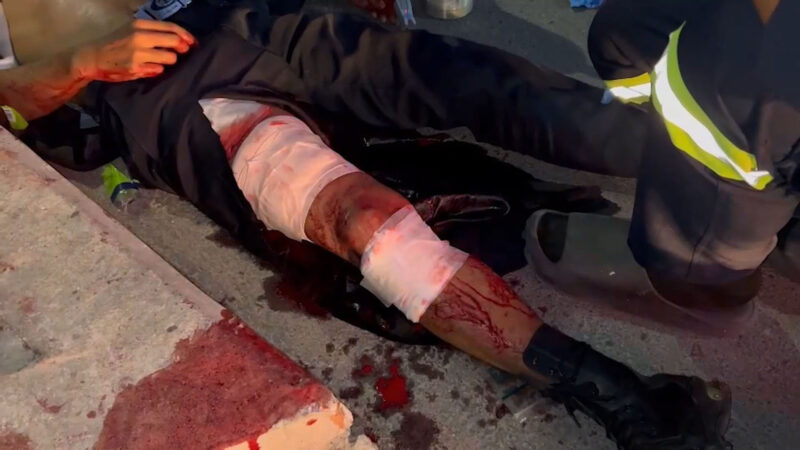 รปภ.สายโหดใช้มีดแทงหัวหน้ารปภ.สาหัส ฉุน “ห้ามศึกแย่งกาต้มน้ำ”