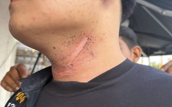 กู้ภัยพัทยา หวิดคอขาดขี่ จยย.ถูกสายอินเทอร์เน็ตห้อยกลางถนนเกี่ยวคอรถล้มเจ็บสาหัส