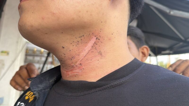 กู้ภัยพัทยา หวิดคอขาดขี่ จยย.ถูกสายอินเทอร์เน็ตห้อยกลางถนนเกี่ยวคอรถล้มเจ็บสาหัส