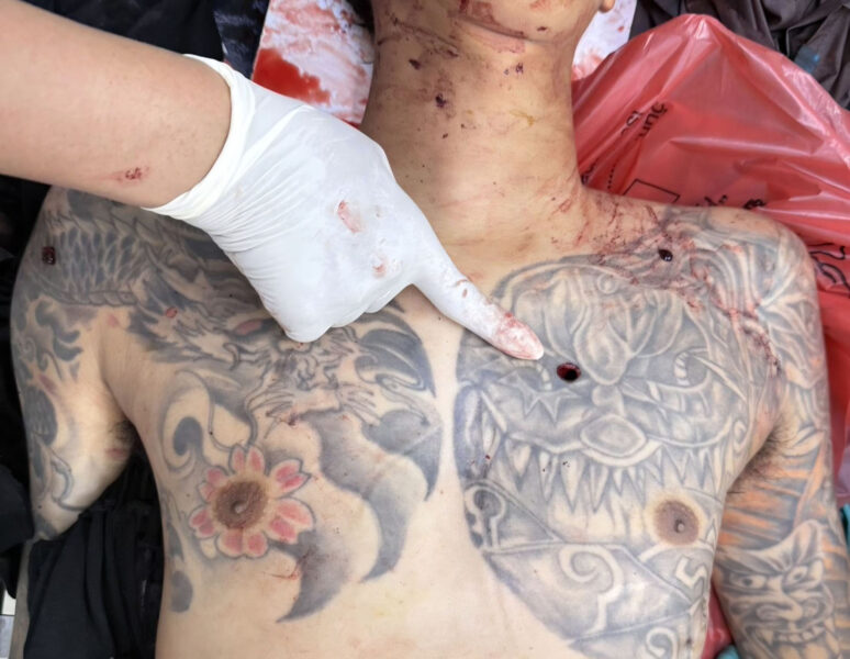 สงกรานต์พระประแดงเดือด 2 สามีภรรยา ถูกมือปืนตามมายิงขณะกำลังเข้าซอยกลับบ้าน บาดเจ็บสาหัสกู้ภัยแพทย์เร่งช่วยเหลือสุดท้ายสามีเสียชีวิตที่ รพ.