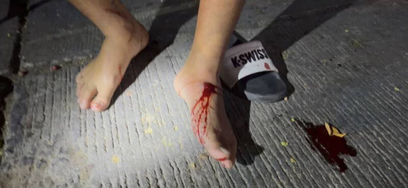 เย้ยกฎหมาย 3 โจ๋ ควงปืนถ่ายวีดีโอบุกยิง 3 นัดใส่กลุ่มวัยรุ่นคาหน้าบ้านพักย่านบางเสาธงกระสุนถูกหลังเท้าวัยรุ่นอายุ 22 ปีได้รับบาดเจ็บ