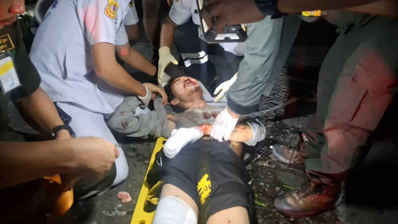 ระทึกข้างย่านสำโรง หนุ่มวัย 27 ปี ถูกระเบิดบาดเจ็บสาหัส ตำรวจเร่งหาสาเหตุ มีวงจรปิดได้ยินเสียตอนระเบิด