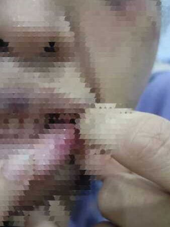 อดีตสามีทหารยศจ่าควงปืนและมีดบุกห้องพักอดีตภรรยา ก่อนซ้อมทำร้ายร่างกายบังคับโดดตึก 5 ชั้นบาดเจ็บ