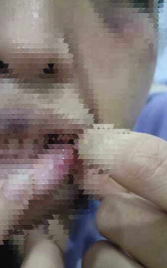 อดีตสามีทหารยศจ่าควงปืนและมีดบุกห้องพักอดีตภรรยา ก่อนซ้อมทำร้ายร่างกายบังคับโดดตึก 5 ชั้นบาดเจ็บ