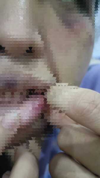 อดีตสามีทหารยศจ่าควงปืนและมีดบุกห้องพักอดีตภรรยา ก่อนซ้อมทำร้ายร่างกายบังคับโดดตึก 5 ชั้นบาดเจ็บ